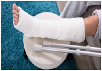 Accident Fracture Orthopedic Facilities